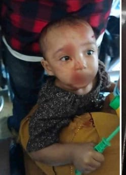 মহাখালীতে ট্রেনে শিক্ষার্থীরা ইট ছোড়ায় রক্তাক্ত শিশু